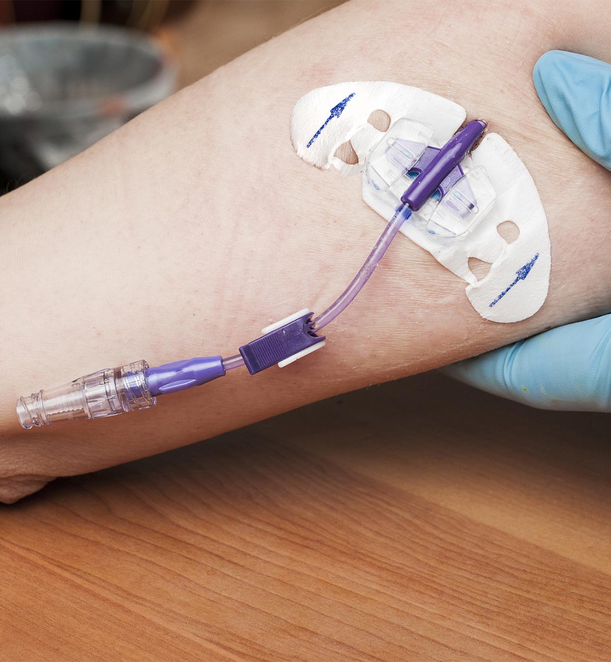 Bianca Verpoest enlevement PICC Line