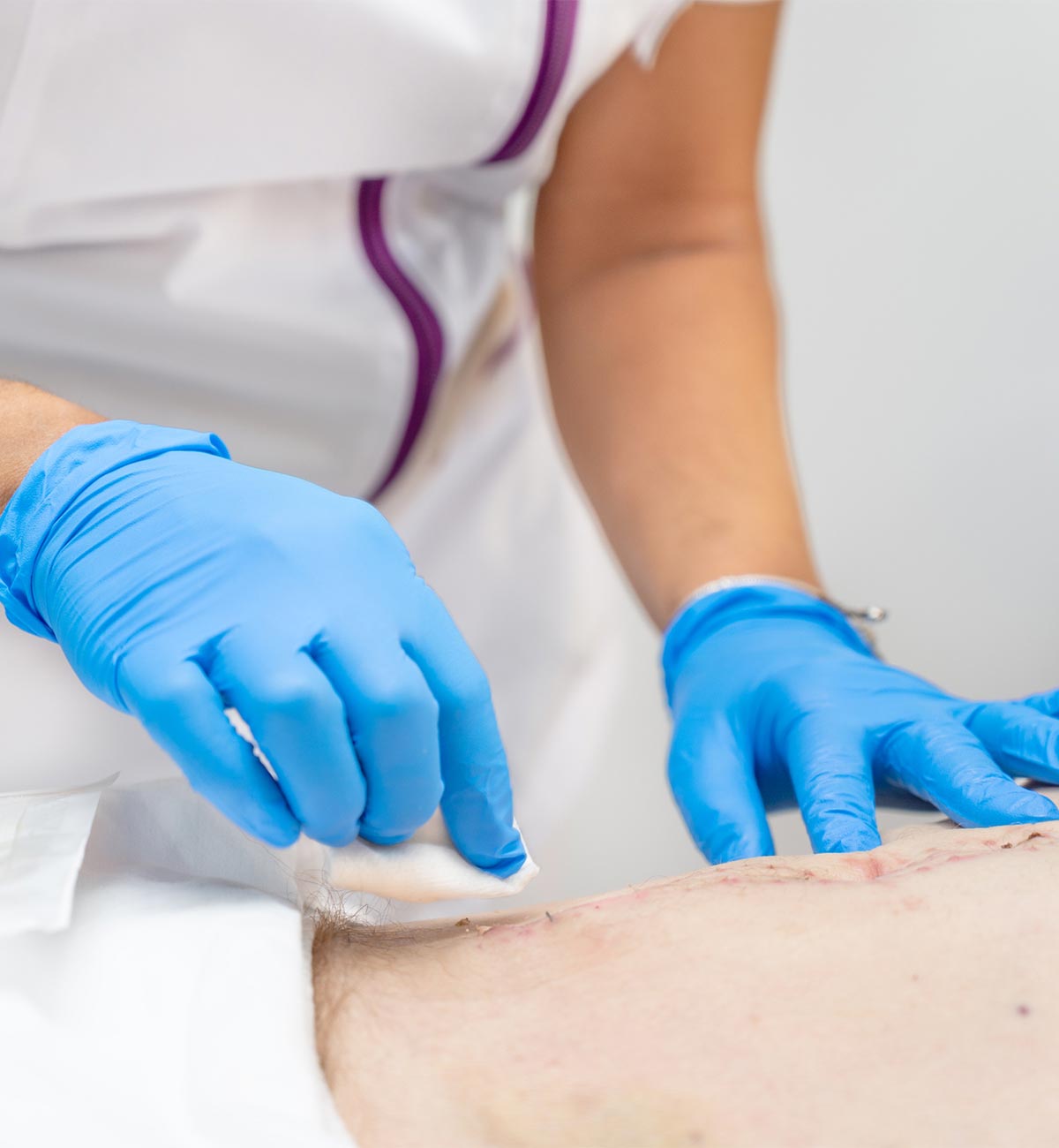 Bianca Verpoest soins de plaies complexes